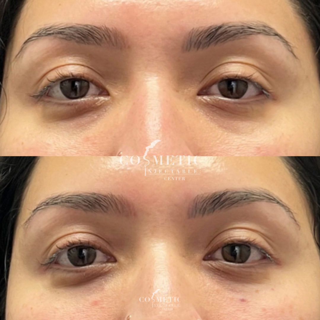 Untitled Design | Cosmetic Injectables Center Medspa | Sherman Oaks, Los Angeles, Ca