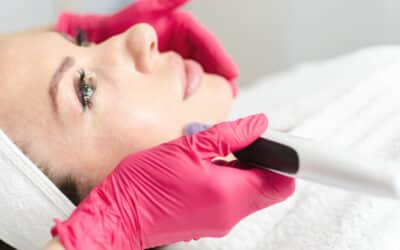 Microneedling Sherman Oaks