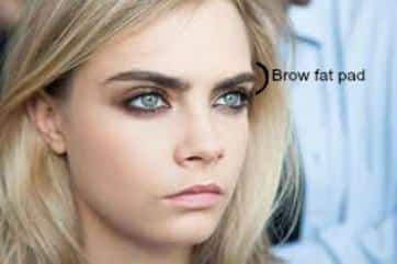 young blonde woman brow fat pad | Cosmetic Injectables Center Medspa | Sherman Oaks, Los Angeles, CA