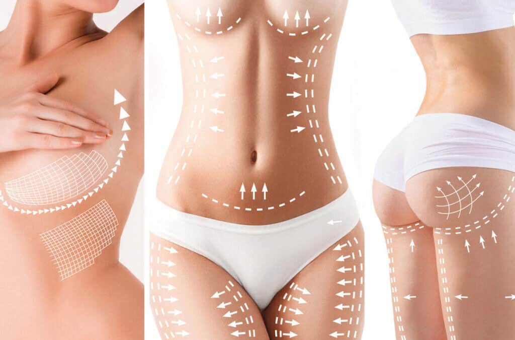 Hottest Body Sculpting Trends Of 2022