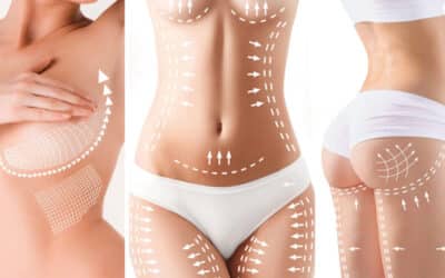 Hottest Body Sculpting Trends Of 2022