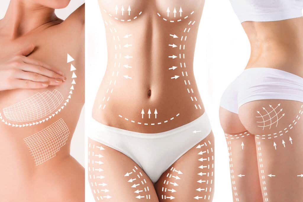 Hottest Body Contouring Trends Of 2022