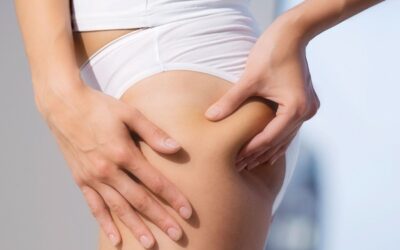 How To Get Rid Of Cellulite On Legs & Buttocks