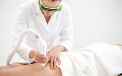 Laser For Veins Sherman Oaks