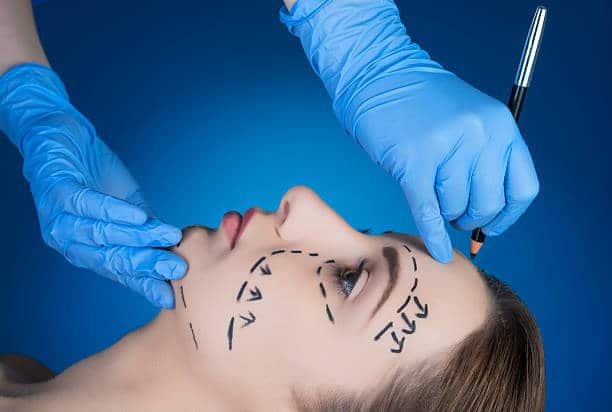 Practitioner Marking Incision To Female Patient For Facelift Surgery