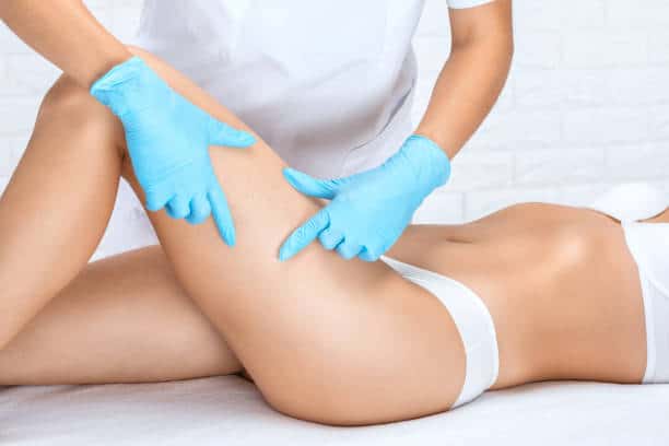 Woman'S Leg Veins Preparing For Laser Vein Procedure