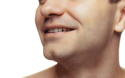 Jawline Injections For Men Sherman Oaks, Ca