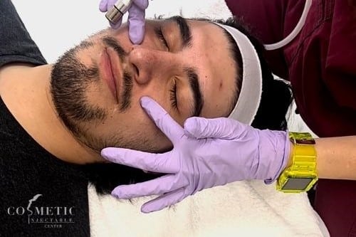 Dr. Soleiman Performing Microneedling Skin Care Treatment For Men In Sherman Oaks