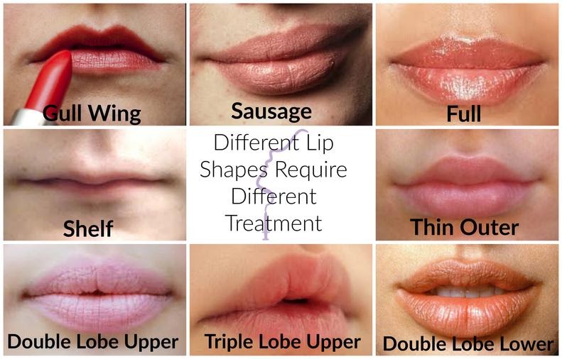Various Lip Shapes Collage Indicating Gull Wing, Sausage, Full, Shelf, Thin Outer, Double Lobe Upper, Triple Lobe Upper, And Double Lobe Lower Types For Targeted Cosmetic Treatments