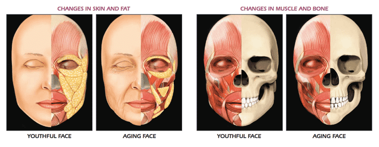 Anatomical Differences In Youthful Versus Aging Face Showing Changes In Skin, Fat, Muscle, And Bone