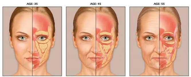 Age-Related Facial Muscle Decline At Ages 35, 45, And 55 Showing Progressive Muscle Loss