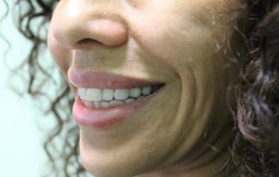 Close-Up Of A Healthy, Natural Smile With A Focus On Teeth And Lower Cheek