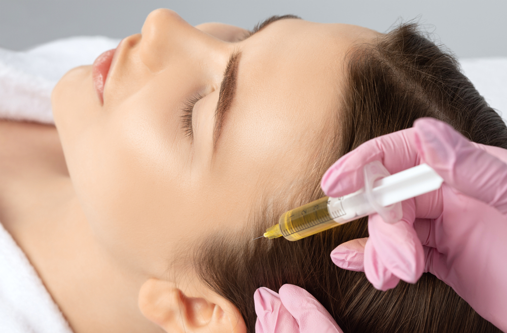 Prp/Prf Hair Restoration Procedure Performed On A Female Patient, Showcasing The Technique Of Injecting Into The Scalp.