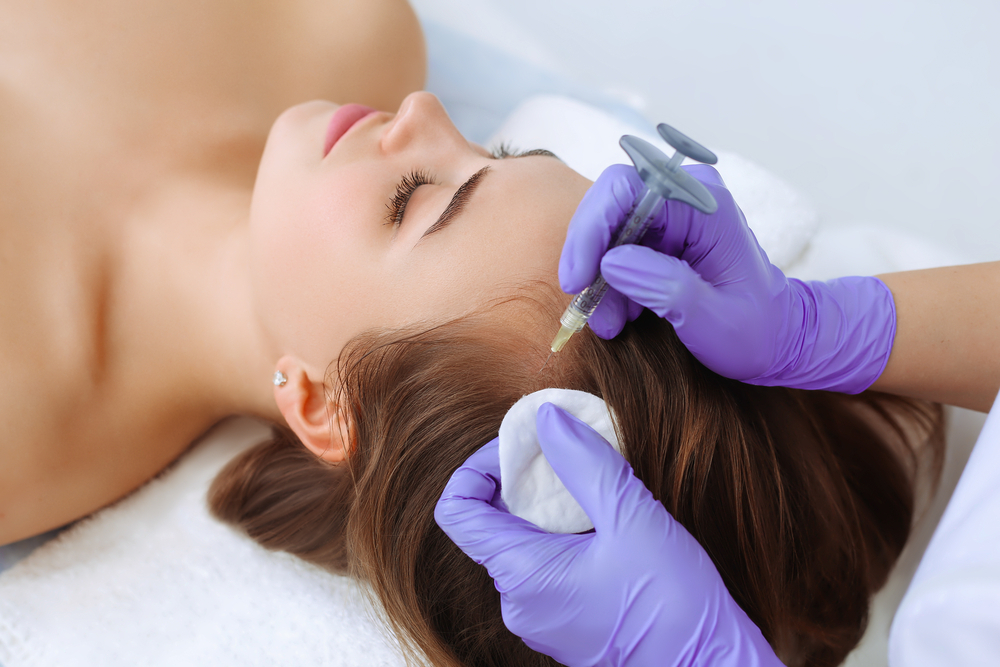 Microneedling Treatment For Hair Restoration Using Prp, Prf, And Prfm Techniques In Sherman Oaks Clinic.