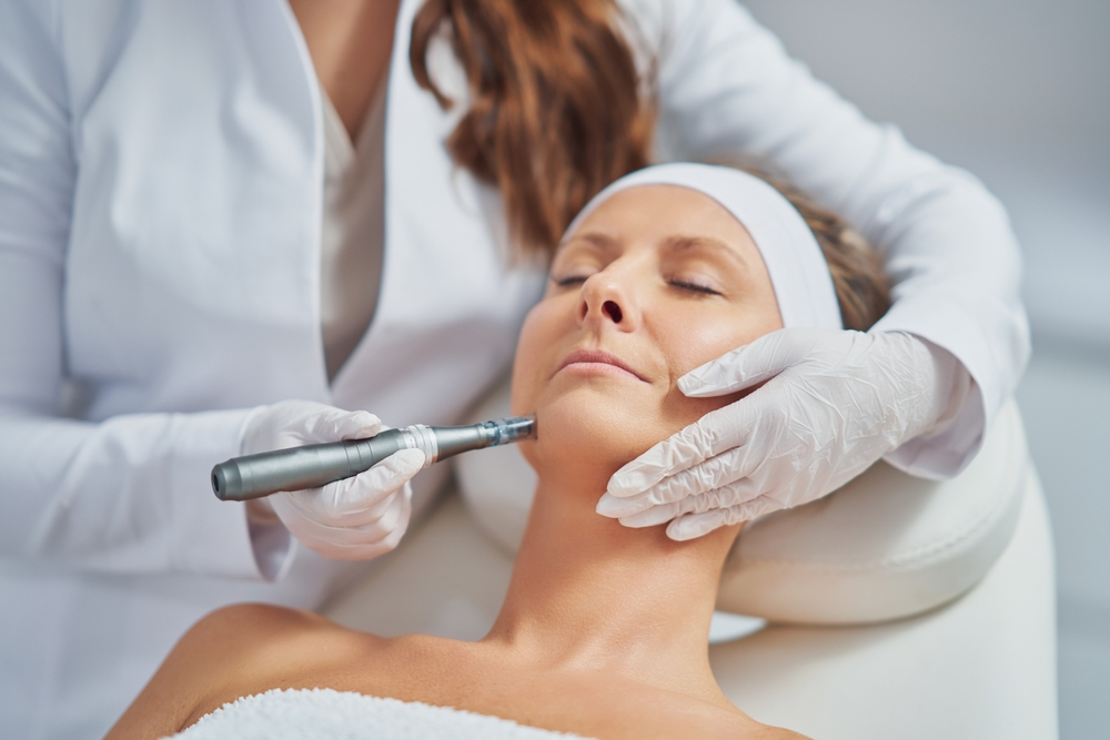 Microneedling Treatment To Female Patient