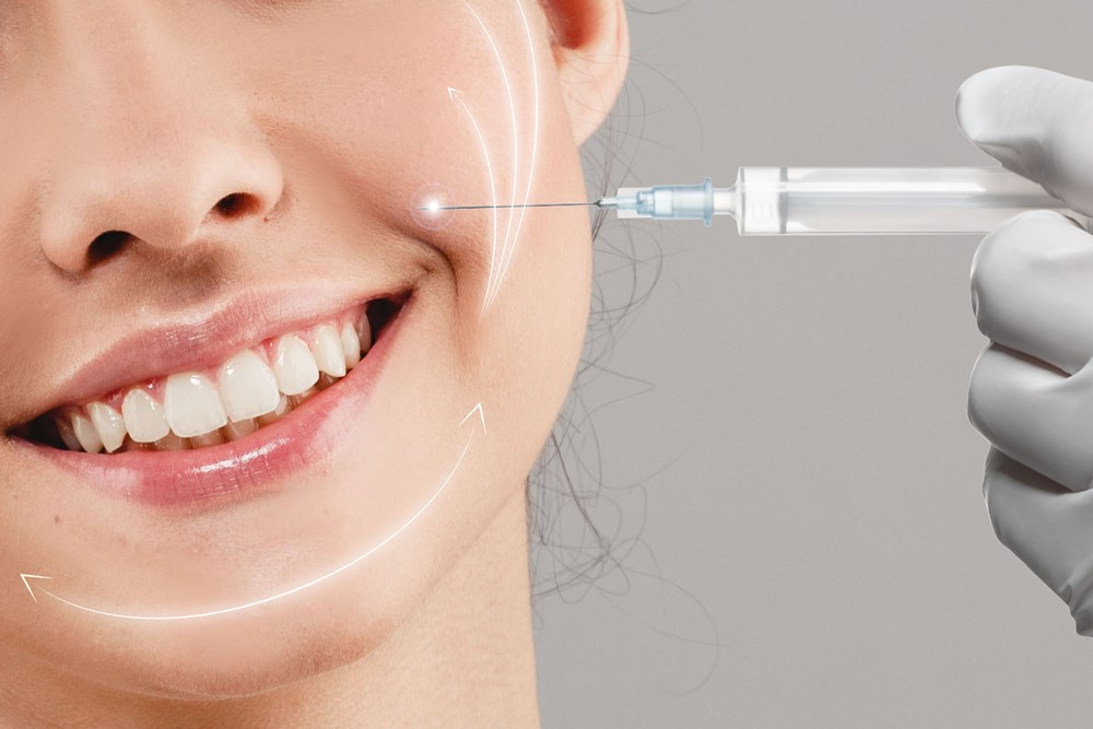 Beauty Woman Face Smile Injects Versa Filler