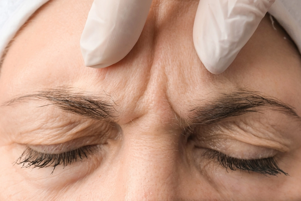 Close-up of a cosmetologist's hands preparing for a Jeuveau forehead wrinkle treatment on a patient.