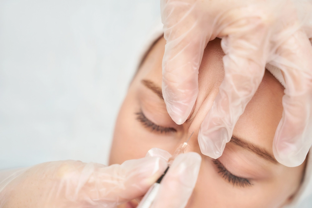 Woman receiving Jeuveau injection treatment for frown lines with marked facial areas for precision in cosmetic procedure.