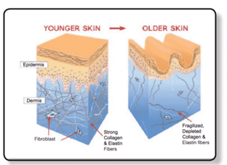 Laser Collagen Stimulation