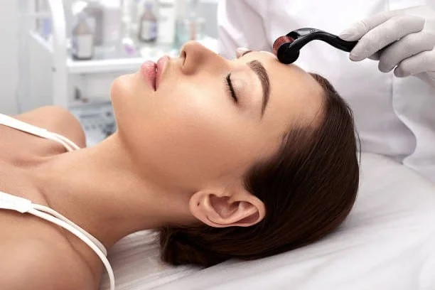 A Woman Undergoing A Non-Surgical Microneedling Procedure For Collagen Stimulation And Skin Revitalization In A Clinical Setting.