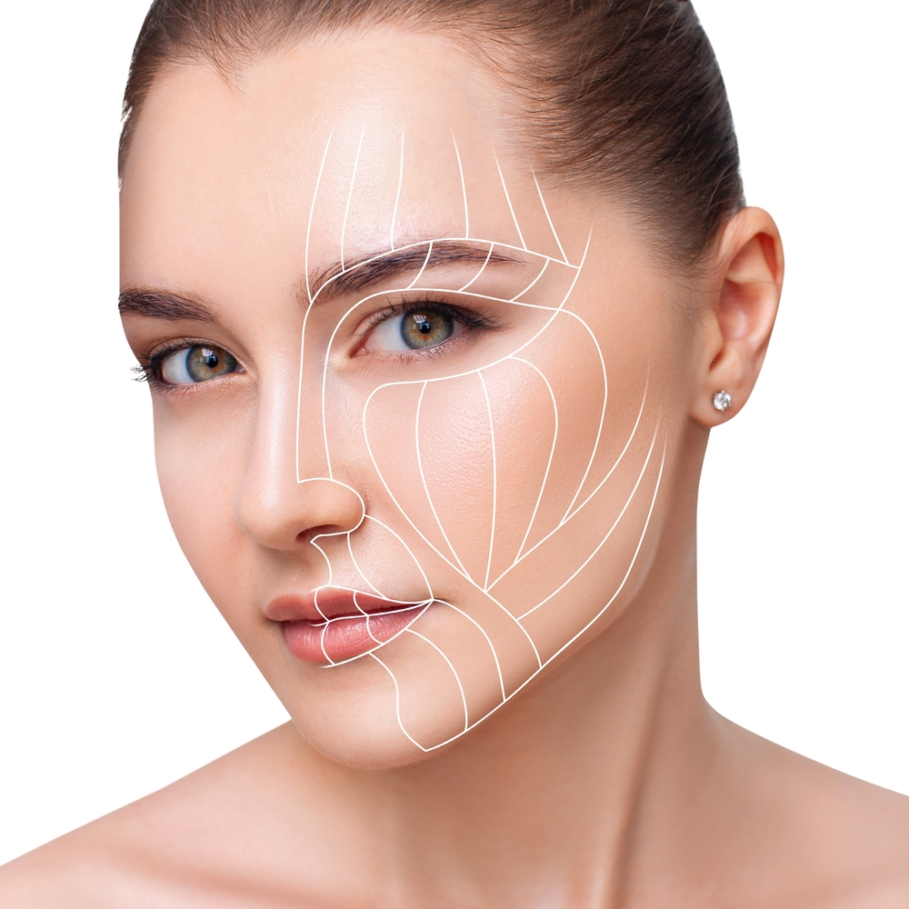Rha 3 Treatment Areas Highlighted On A Woman'S Face At Cosmetic Injectables Center In Sherman Oaks.