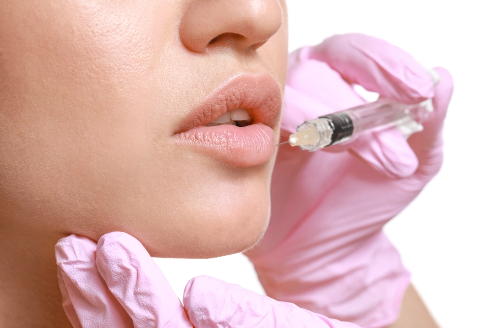 Close-Up Of A Woman'S Lips Receiving An Rha Injection Procedure At Cosmetic Injectables Center