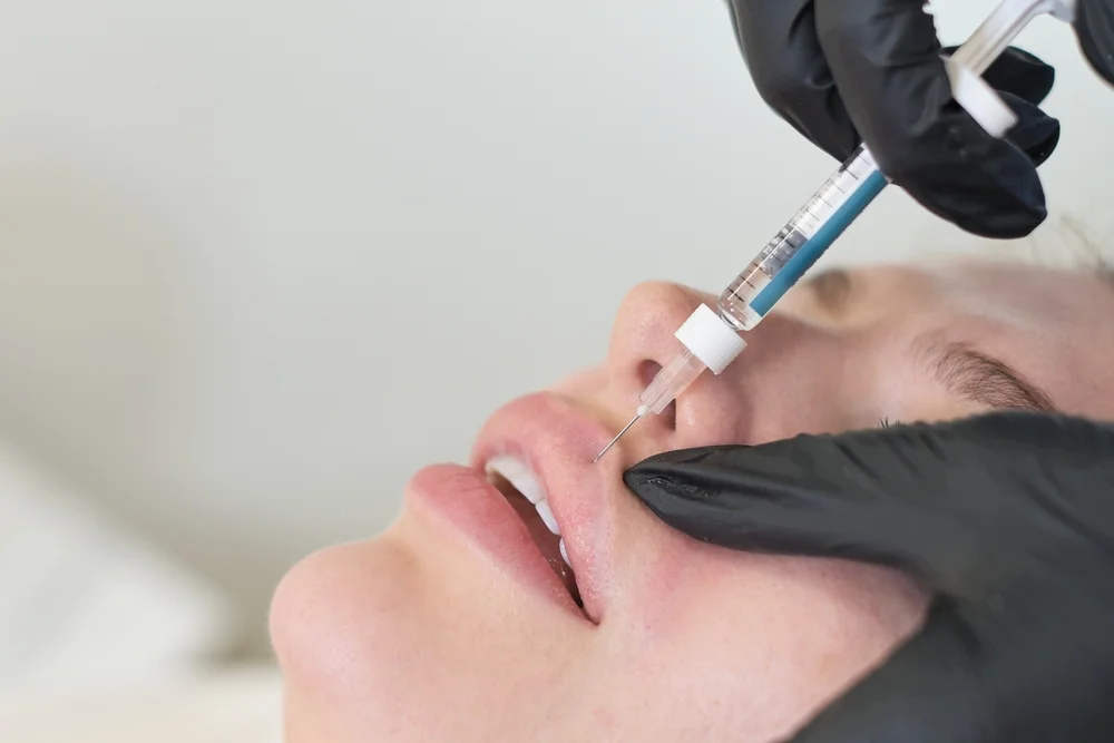 Patient Receiving An Voblella Injection For Lip Enhancement