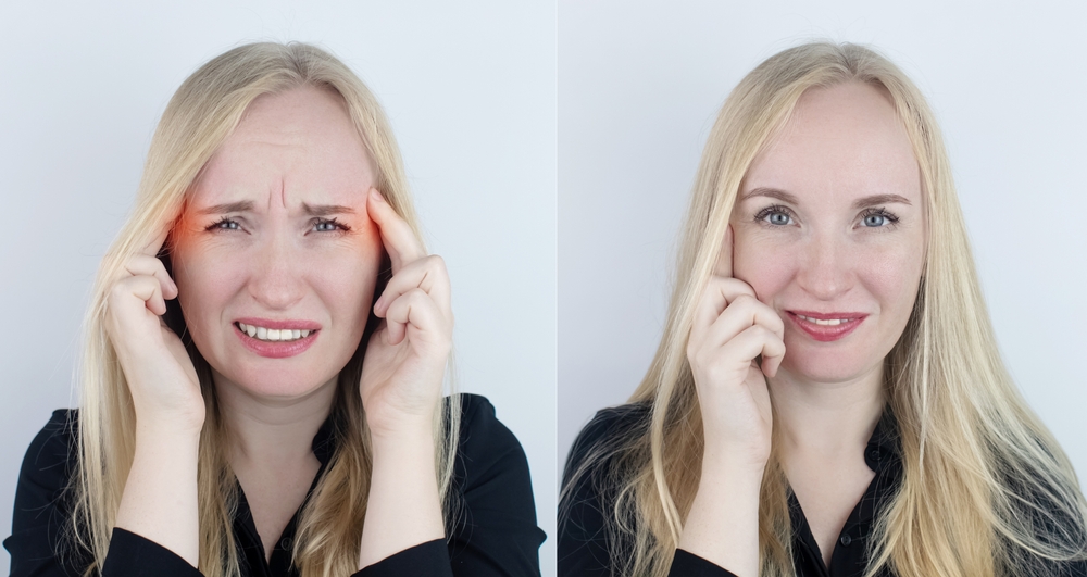 botox-for-migraine-treatment-before-and-after