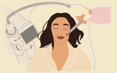 Laser Skin Resurfacing Sherman Oaks, Ca